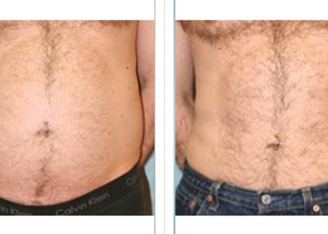 Freezing Fat Cells DIY: What Actually Works and What’s Dangerous