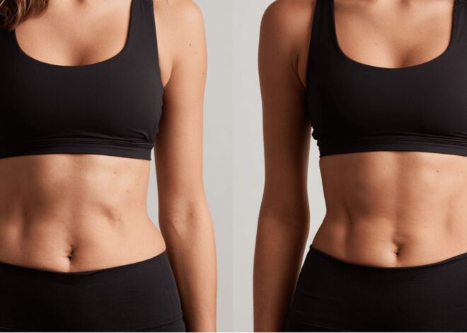 Ice Pack Fat Loss Before and After: The Truth About Fat Freeze at Home