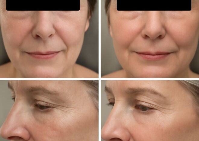 Facial Fat Transfer: What to Expect Before, During, and After