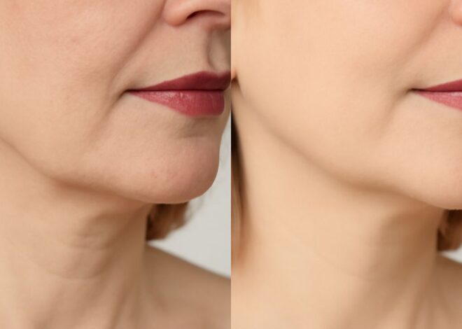 How to Lose Face Fat: Practical Methods That Actually Work