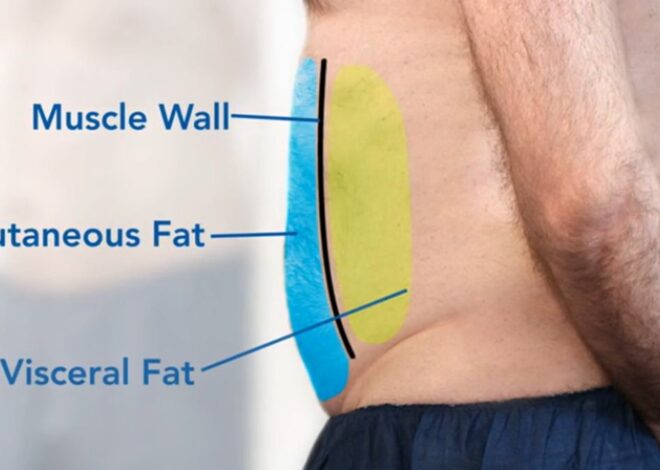 Fat Distribution: Body Fat Types and What Where You Store Fat Means