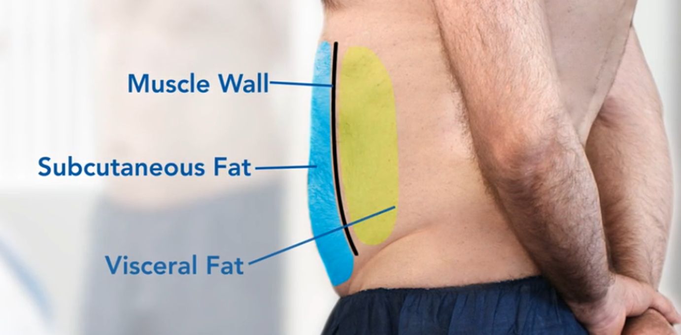 Fat Distribution: Body Fat Types and What Where You Store Fat Means