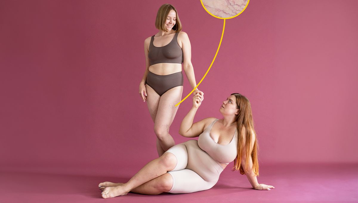 Loose Skin vs Fat: How to Tell the Difference and What to Do About It