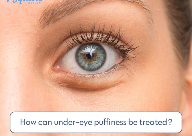 Fat Deposits Under Eyes: Causes and Solutions