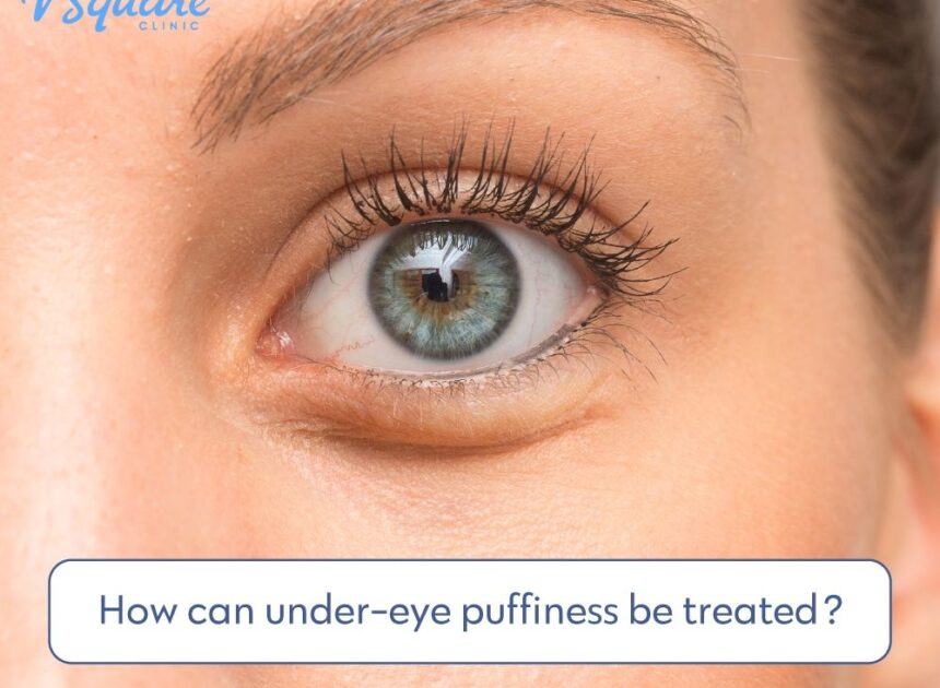 Fat Deposits Under Eyes: Causes and Solutions