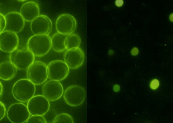 Perinephric Fat Stranding and Its Nutritional Implications