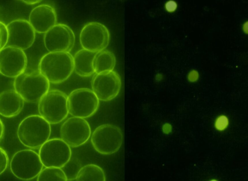 Perinephric Fat Stranding and Its Nutritional Implications