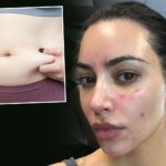 Kim Kardashian fat ass and camel fat insights